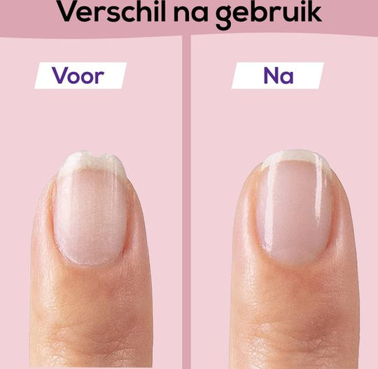 SafeCare™ Baby Nagelvijlset – Elektrisch, Veilig en Geruisloos Vijlen voor Baby’s